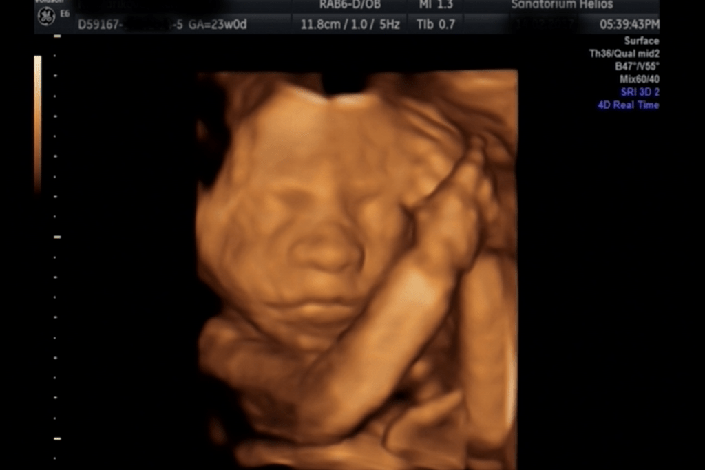obrázek ze 3D ultrazvuku 3