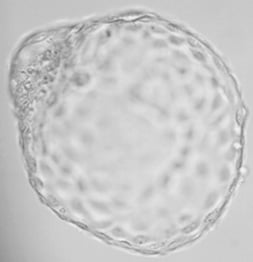 Proč spolupracujeme se společností Genea? 6 - Sanatorium Helios CZ Proč spolupracujeme se společností Genea? 5 - Sanatorium Helios CZ