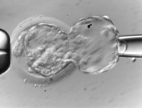Proč spolupracujeme se společností Genea? 2 - Sanatorium Helios CZ Proč spolupracujeme se společností Genea? 1 - Sanatorium Helios CZ