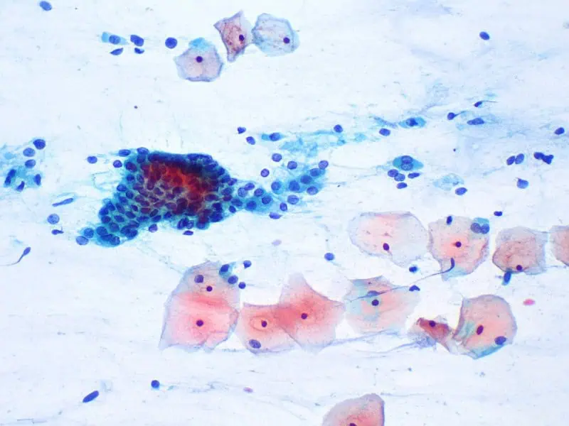 Onkologická cytologie 2 - Sanatorium Helios CZ Onkologická cytologie 1 - Sanatorium Helios CZ