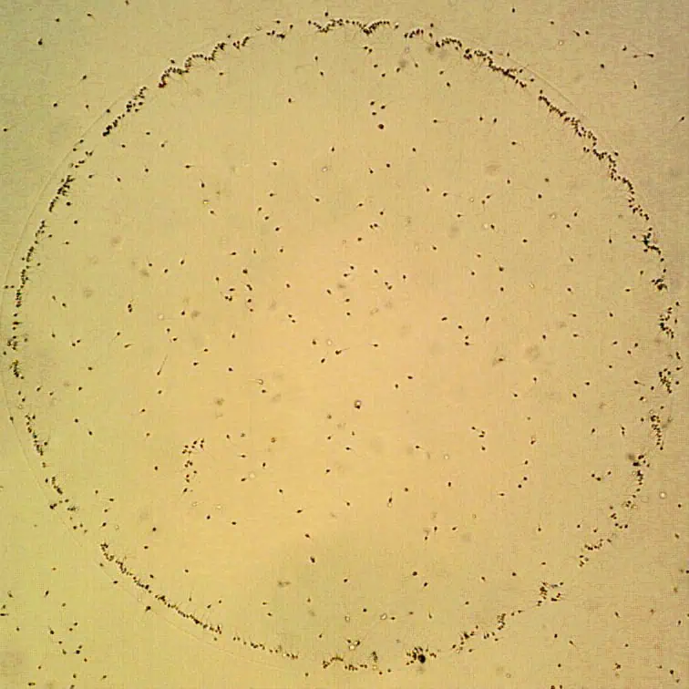 Volba metody oplození vajíček 1 - Sanatorium Helios CZ PICSI v praxi