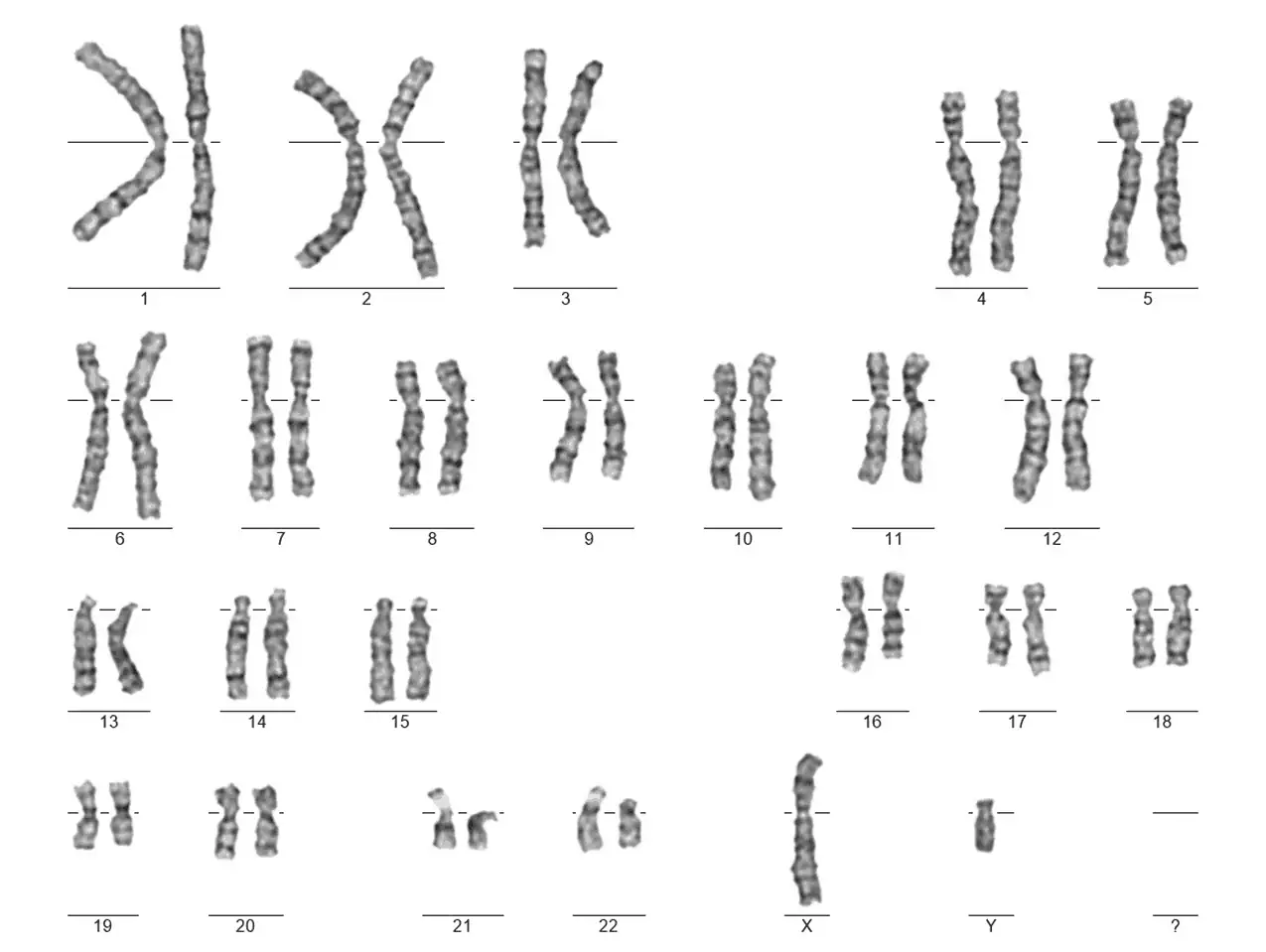 Cytogenetické vyšetření 1 - Sanatorium Helios CZ karyotyp muže