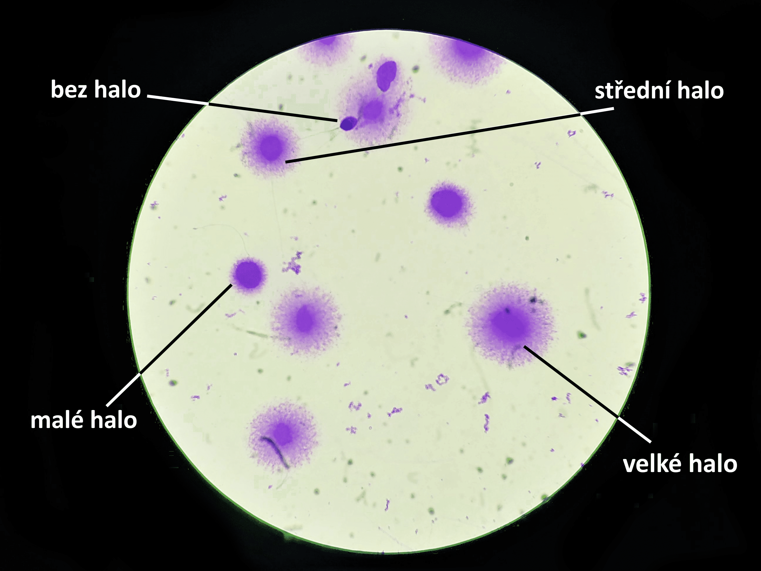Funkční testy spermií 1 - Sanatorium Helios CZ DNA fragmentace spermií