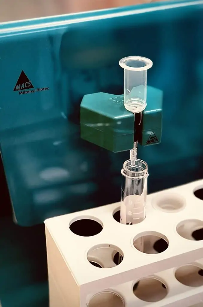 Metody zpracování spermií 6 - Sanatorium Helios CZ Metody zpracování spermií 5 - Sanatorium Helios CZ