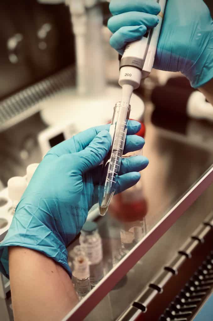 Metody zpracování spermií 1 - Sanatorium Helios CZ