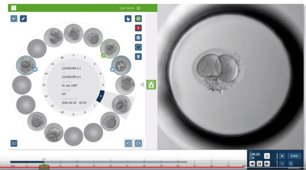 Umělá inteligence v IVF 1 - Sanatorium Helios CZ inkubátor Geri pro IVF