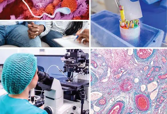 ESHRE Annual Meeting v Amsterdamu